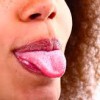 舌のやけどを早く治す方法！砂糖や蜂蜜を舐める効果とは？